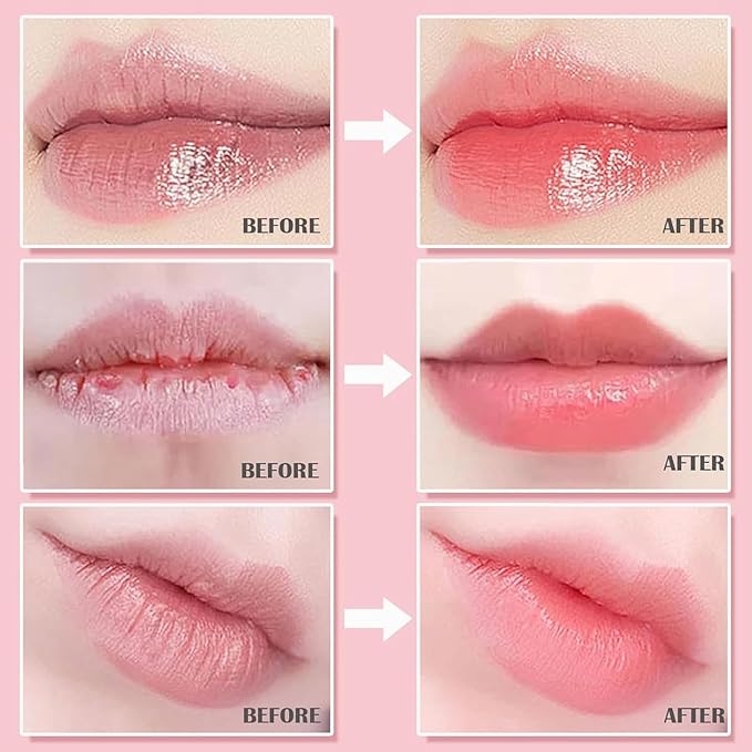6Pcs Bee Lip Balm Honey Pot, Strawberry, Watermelon, Apple Lime, Cherry, Mint, Honey Lip Balm Bulk, Lip Mask Sleeping Prevention Lip Dry Set, Lip Balms & Moisturizers, Mothers Day Gifts