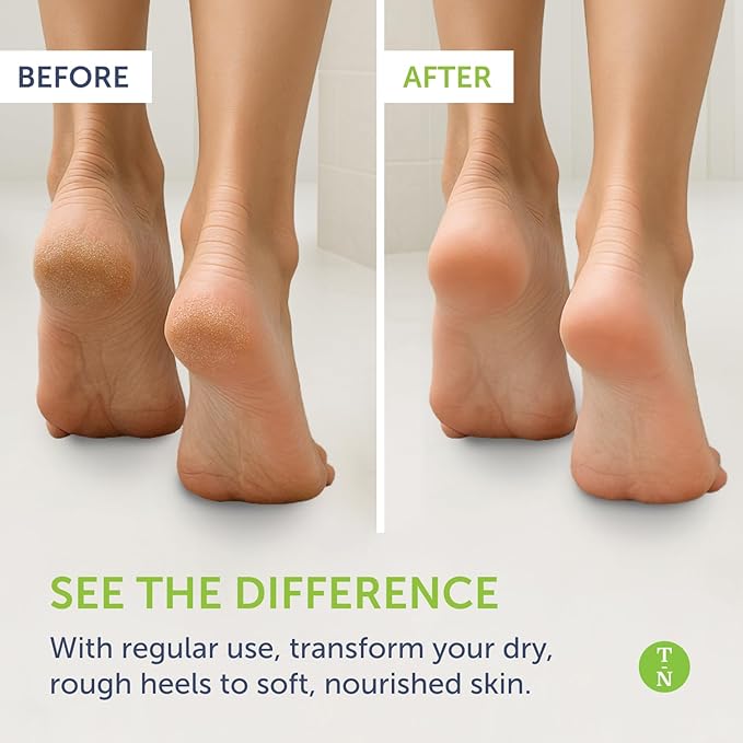 Truremedy Naturals Remedy Balm with Tea Tree Oil, 2 oz - Soothing Moisturizer for Rough Areas - Nourishing Foot and Body Balm with Tea Tree, Lavender, and Eucalyptus (Pack of 2)