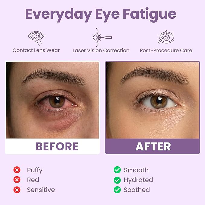 Lure Essentials Steam Eye Mask, Heated Eye Mask, Self Heating Warm Compress for Dry Eyes, Fast Relief for Stye, Puffy Sensitive Eyes, Moist Heat, Relaxation Gifts for Women and Men - Lavender
