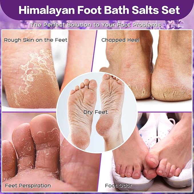 3 Pack Foot Soak Salts Kit Epsom Salt - Himalayan Pink Salt - Dead Sea Salt - Foot spa Care Best for Good Sleep Essential Oils Tea Tree Oi Lavender Rose for Women
