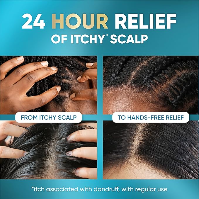 Head & Shoulders Royal Oils Scalp Elixir Treatment, Formulated with Cooling Menthol and Peppermint Oil for Instant Scalp Soothe and Hydration, 4.2 fl oz (Pack of 12)