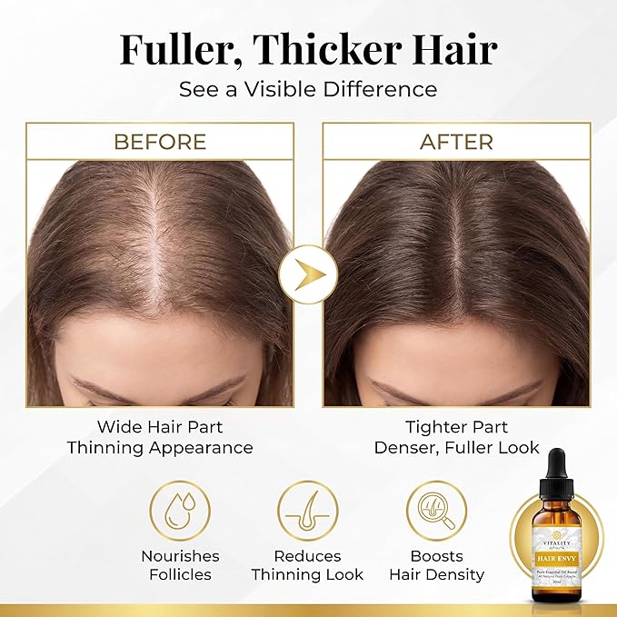 Vitality Extracts Hair Envy - Natural Hair Growth Serum - 100% Pure Essential Oils, 15 Plant Extracts, No Synthetics, No Parabens - Strengthen Hair, Minimize Breakage, Stimulate Follicles